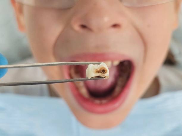 Best Knocked-Out Tooth Emergency  in Ardmore, PA
